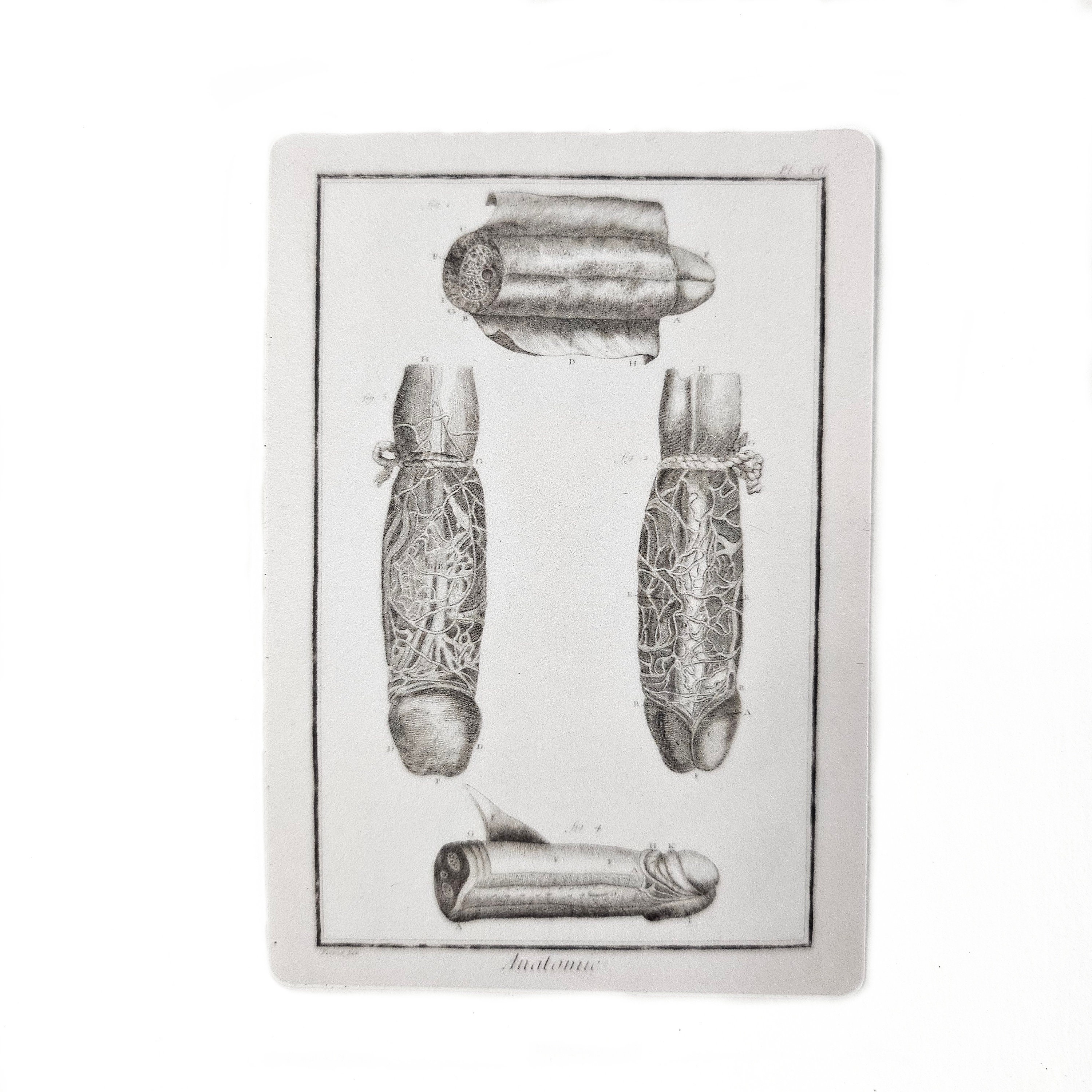 Antique Penis Sticker, Anatomical Male Genitalia Anatomy, Weird Vintage Genitals, Medical Diagram, Vinyl Decal, Doctor or Nurse Gift - Thumbnail 2