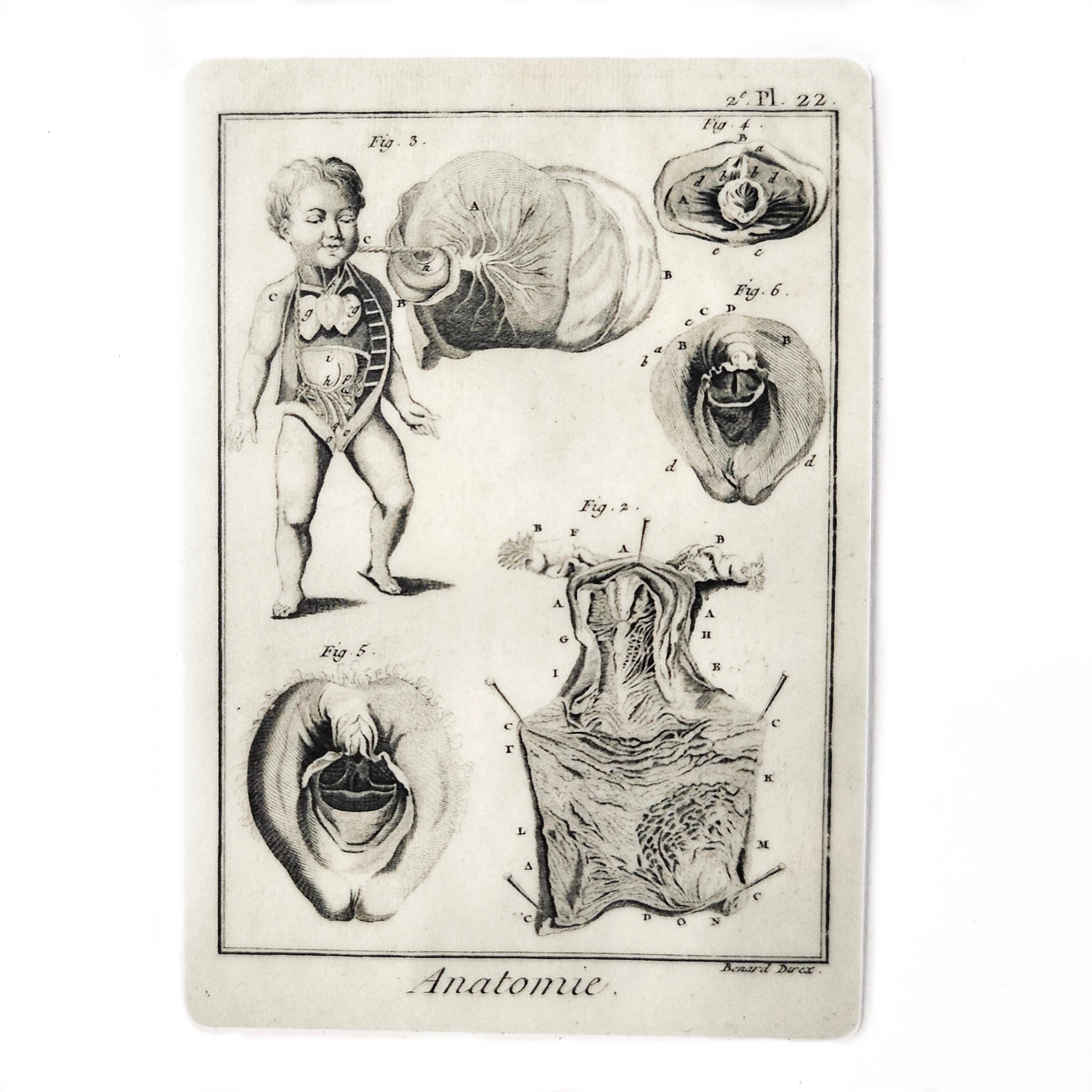 Female Anatomy Sticker, Anatomical Woman Genitalia, Women's Reproductive Rights, Pro Choice, Weird Medical Diagram, Doctor Nurse GYN - Thumbnail 2