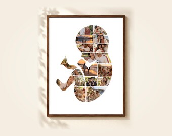 Baby Photo Collage Template, 16 Photos, Editable in Canva