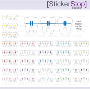 Puede incluir: Un conjunto de 28 imágenes digitales de clipart de dientes con brackets en varios colores. Las imágenes son de 300 dpi y son perfectas para crear pegatinas, tarjetas u otras manualidades personalizadas.
