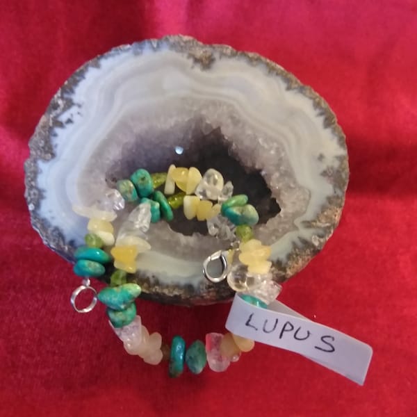 Lupus Holistic Healing Bracelet with genuine gemstones and crystals