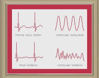 Cross-stitch pattern: EKG arrhythmias