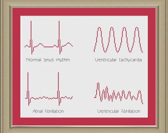 Cross-stitch pattern: EKG arrhythmias