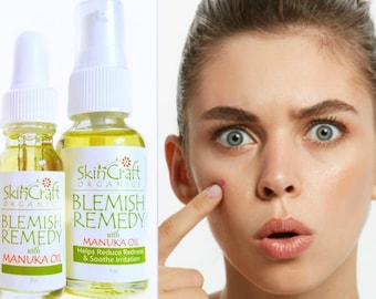 Natural Acne, Pimple, Blemish Spot Treatment Serum - Organic Acne Skin Care Remedy for Pimple Breakouts w/ Thyme, Manuka, Tamanu