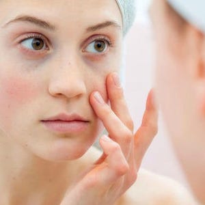 Natural Acne, Pimple, Blemish Spot Treatment Serum Organic Acne Skin Care Remedy for Pimple Breakouts w/ Thyme, Manuka, Tamanu image 3