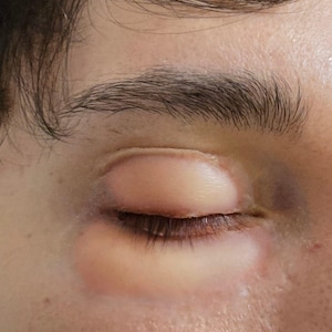 Puffy eyes sfx