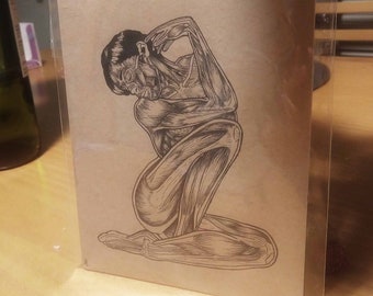 Figure 1 Illustration print