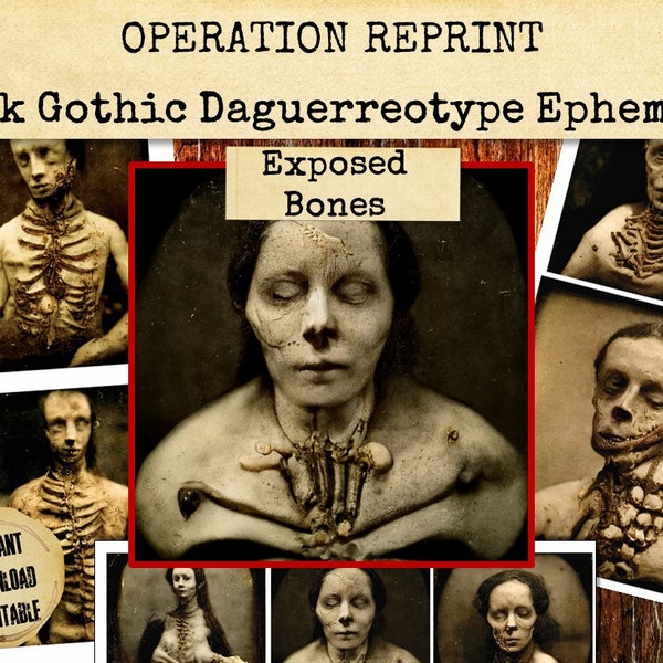 Zombie Vintage Victorian Daguerreotype Photographs Ephemera, Undertaker, Mourning, Death, Exposed Bones, JPEG & PDF Download Printable