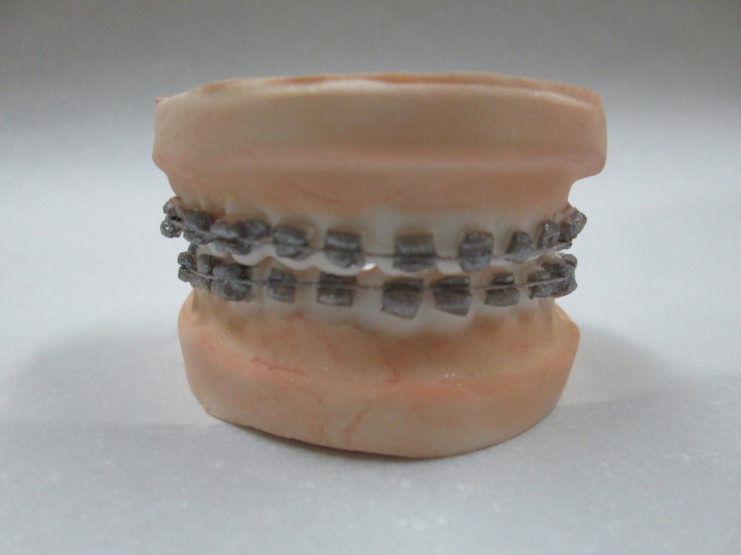 Handmade False Teeth With Braces Birthday Gag Over the Hill Dentures Dentist Orthodontist Cake