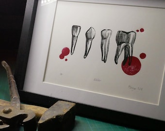 Râtelier - teeth set - anatomy - linocut