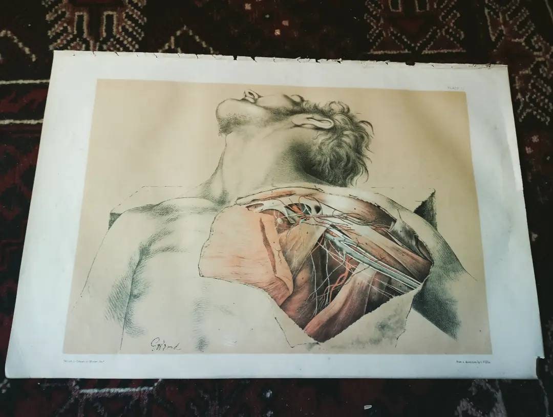 Massive Original, Ready to Frame Anatomical Dissection Lithograph Print ...