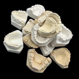 Vintage Plaster Dental Mold - Teeth Tooth Mold - Creepy Oddity - Dental Oddities!