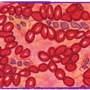 May include: A close-up image of red blood cells, also known as erythrocytes, in a blood smear. The cells are round and have a slightly oval shape. The background is a light pink color.