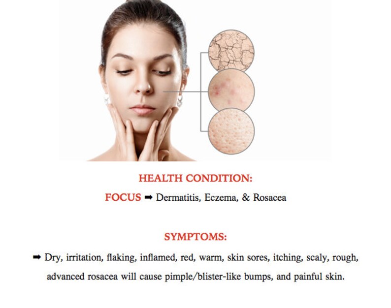 Holistic Skin Care Ebook Instant Download Beauty Eczema Etsy