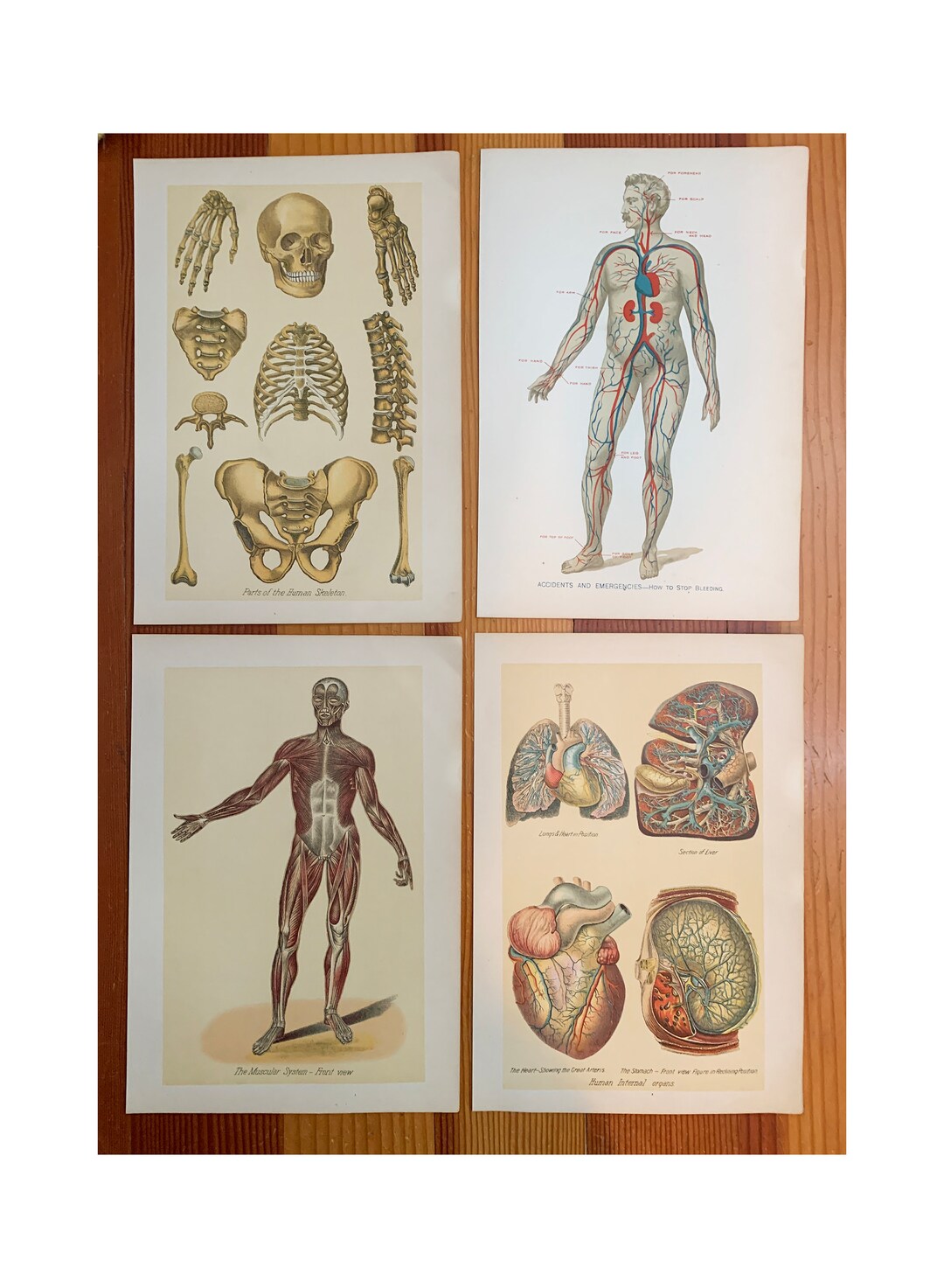 1903 Antique Anatomy Lithograph Plate Print From Rare Medical - Etsy