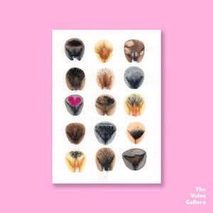 Vulva-galerie Category:Human vulvas