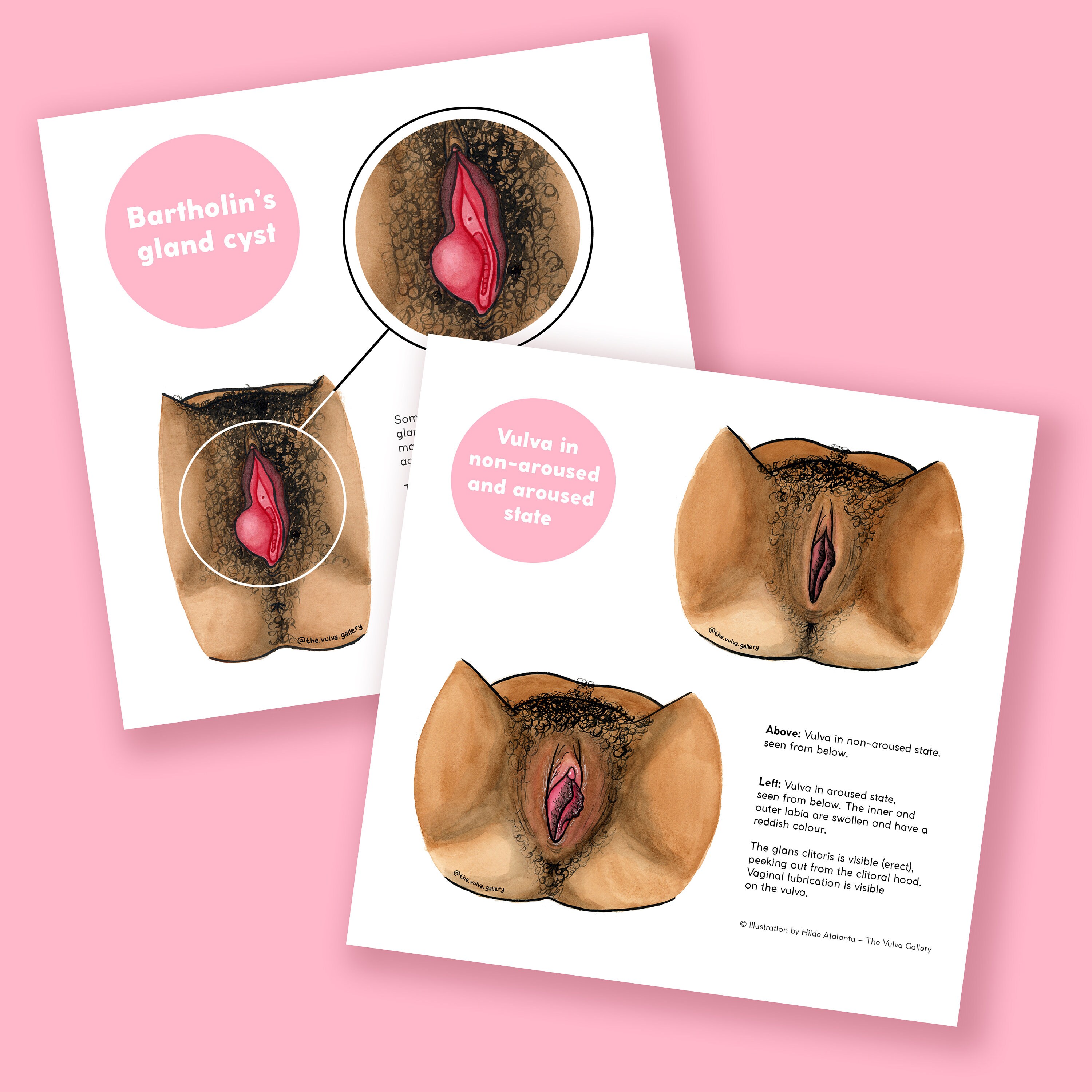 Vulva Anatomy Education Set • English version • 15 prints + 21 digital images • The Vulva Gallery