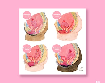 Uterus Variations • Anatomy • Educational Art Print • The Vulva Gallery