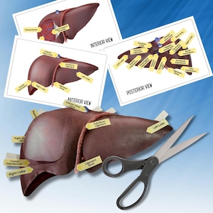 Könnte beinhalten: Anatomische Diagramme der Leber, beschriftet mit Begriffen wie "Right Lobe" und "Inferior Vena Cava". Die Diagramme zeigen Innen-, Vorder- und Rückansichten. Eine Schere befindet sich im Vordergrund.