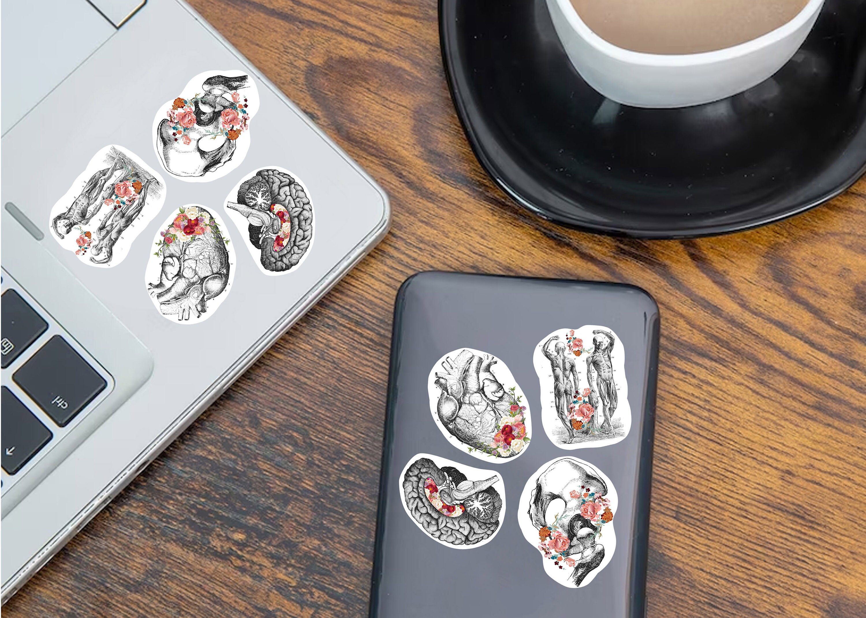 Stent Sticker Anatomy Stickers for Hydroflask - Anatomical Decals for Science Lovers ...