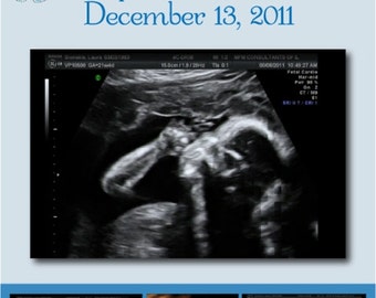 Custom PRINTABLE Sonogram Sign for Baby Shower - 8.5x11