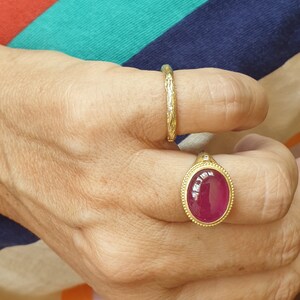 May include: A hand displays two gold rings. One ring features a textured band, while the other showcases a large, oval, ruby-colored stone set in a gold bezel with a beaded border. The background has a striped pattern.