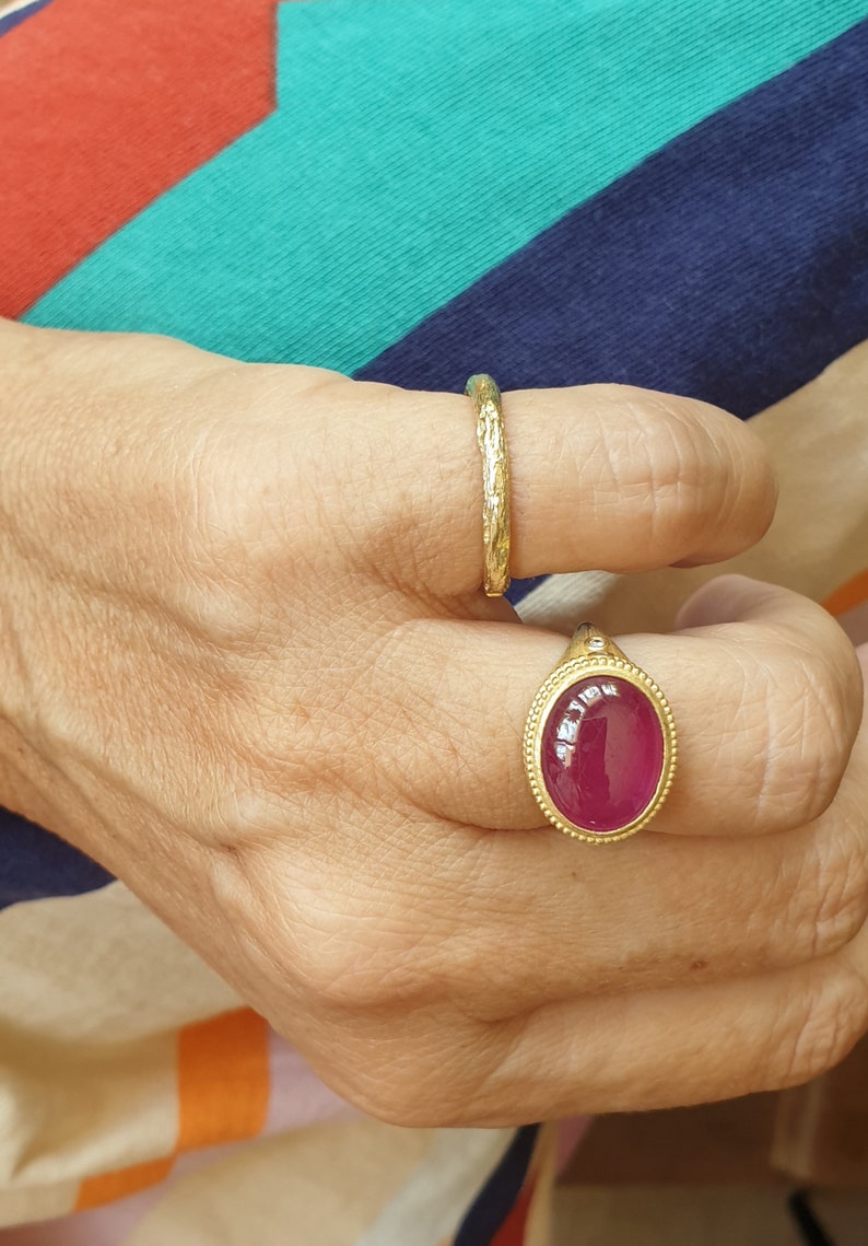 May include: A hand displays two gold rings. One ring features a textured band, while the other showcases a large, oval, ruby-colored stone set in a gold bezel with a beaded border. The background has a striped pattern.