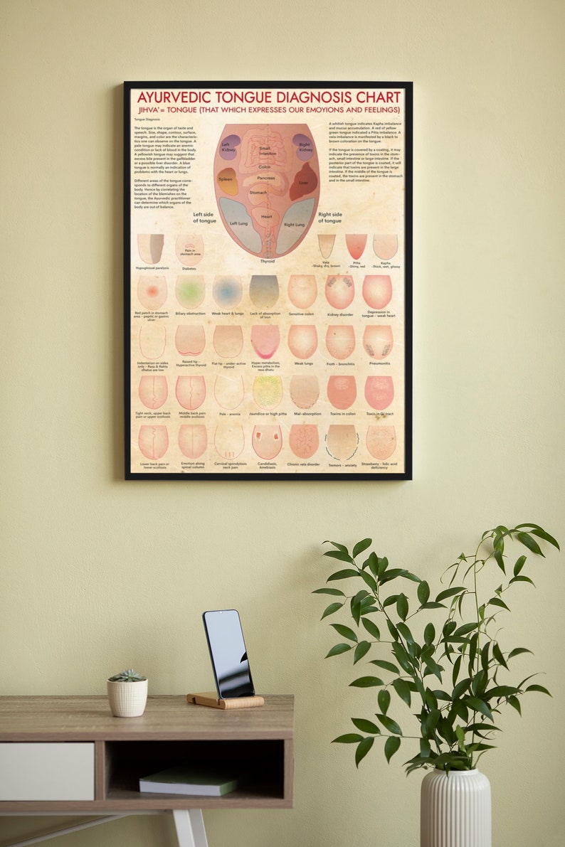 Ayurvedic Tongue Diagnosis Chart Poster, Alternative Medicine, Ayurveda