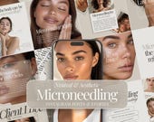 Microneedling | Social Media Bundle | Esthetician Template | Skincare Instagram Template | Esthetician Instagram Post | Instagram Stories