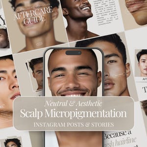 Scalp Micropigmentation | Paramedical Tattoo | SMP Promo | PMU Instagram Post | Permanent Makeup Artist |Social Media Marketing|Microblading