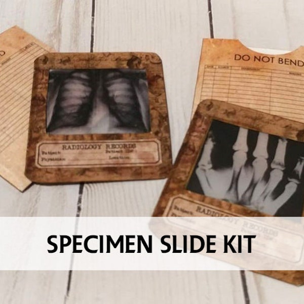 Vintage XRAY Slides Set - Skull - Hand - Chest - Vintage Spinal XRAYS with Pockets - Vintage Medical Xrays - Printable Medical Ephemera