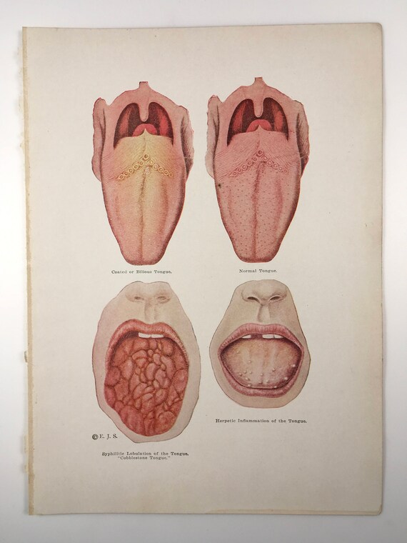 Tongue Color Chart