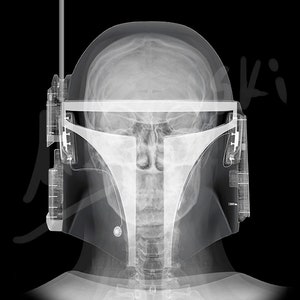 Puede incluir: Una imagen de rayos X de una persona que lleva un casco de Boba Fett. El casco está hecho de plástico y tiene una visera transparente. El cráneo y la columna vertebral de la persona son visibles a través del casco.