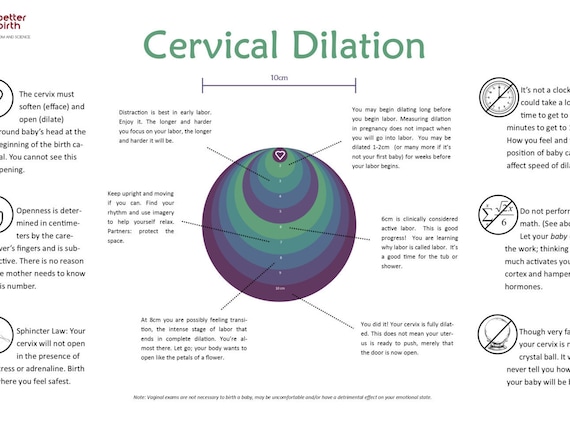 Cervix Poster Labor and Birth Dilation-11x17 printable for | Etsy Cervix Poster Labor and Birth Dilation-11x17 printable for | Etsy