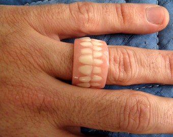 Denture Ring