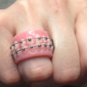 May include: A novelty ring featuring a set of false teeth with silver braces. The teeth are set in a pink gum-like material, creating a unique and quirky accessory. The ring is designed to be worn on a finger.