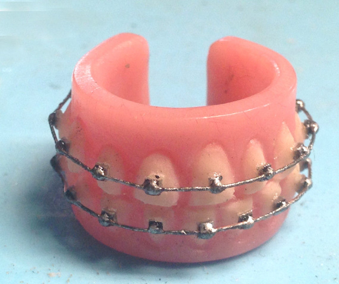 Braces Ring Etsy