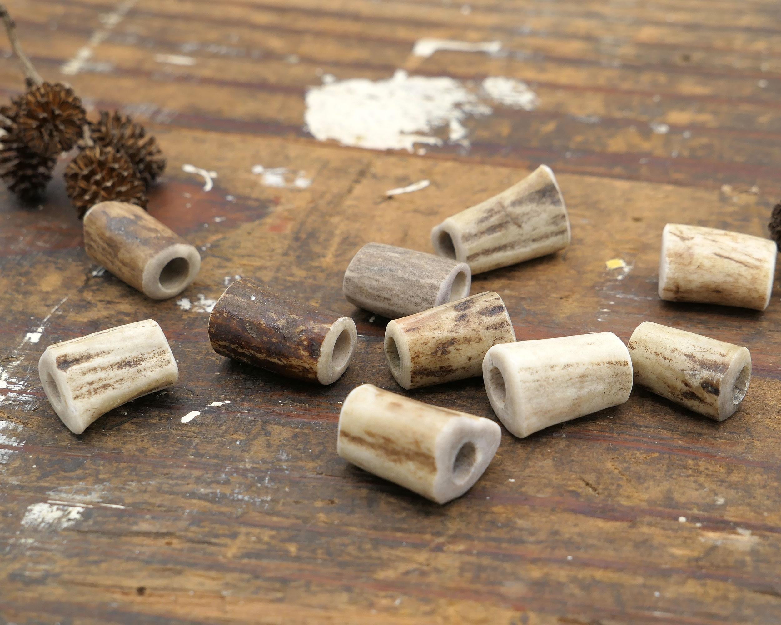 Chambre D' Enfants Avec Ce Joli Cerf - Décoration Et Bijoux Avec Les