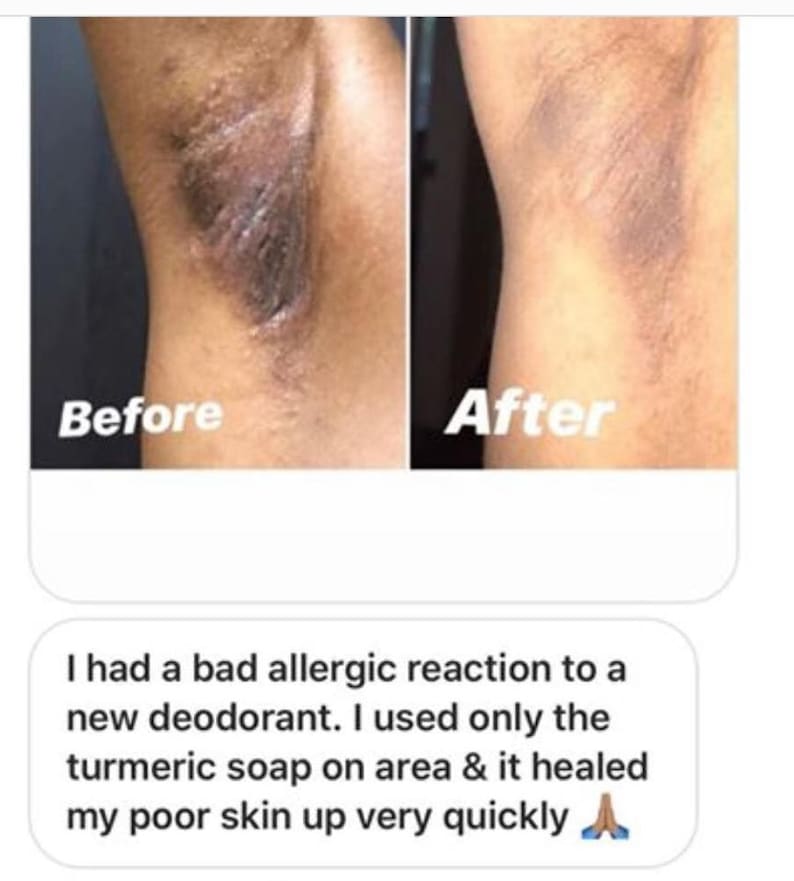 Turmeric Sugar Scrub, Toning and Brightening Face and Body Scrub, Free