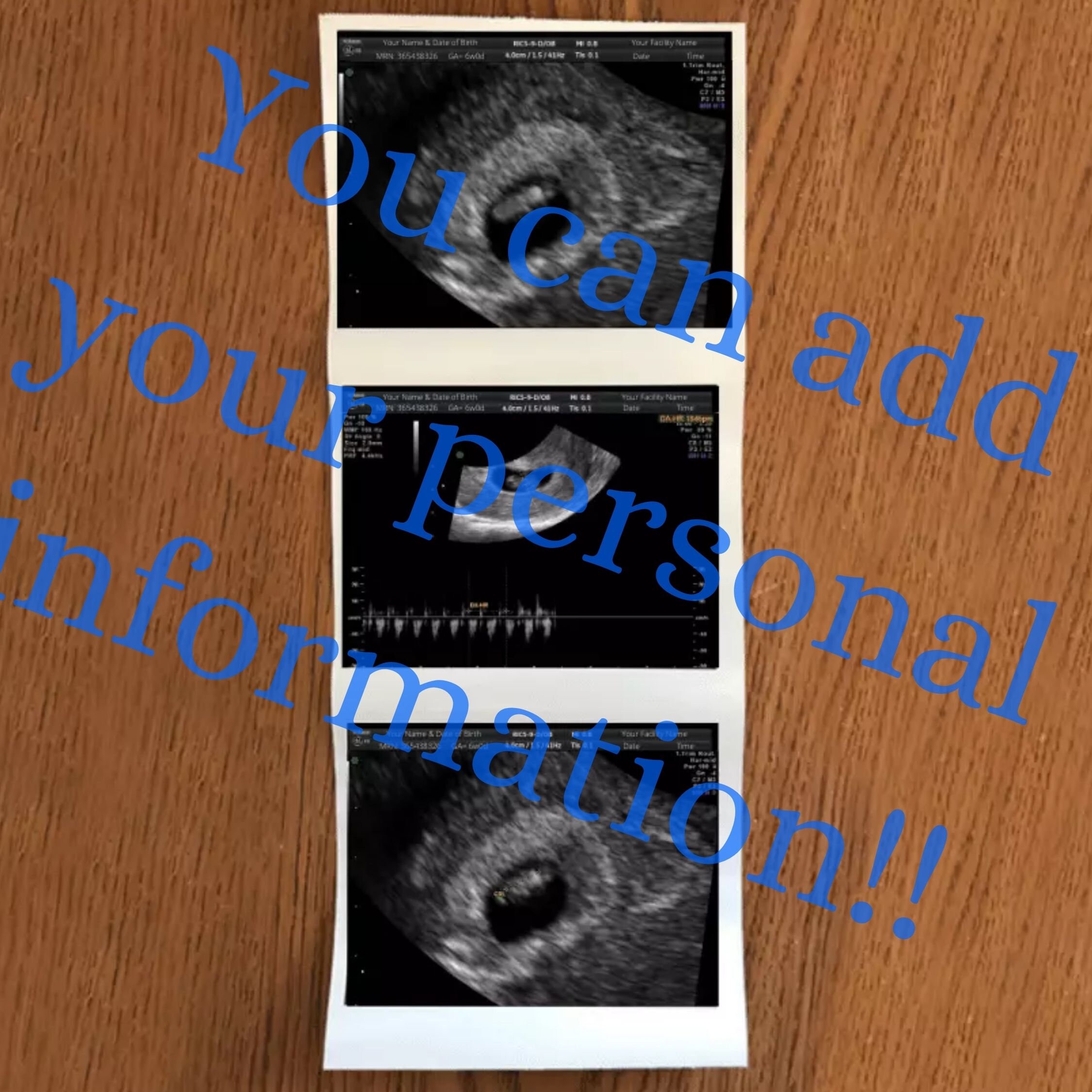 Fake Ultrasound Prank - 4p16961