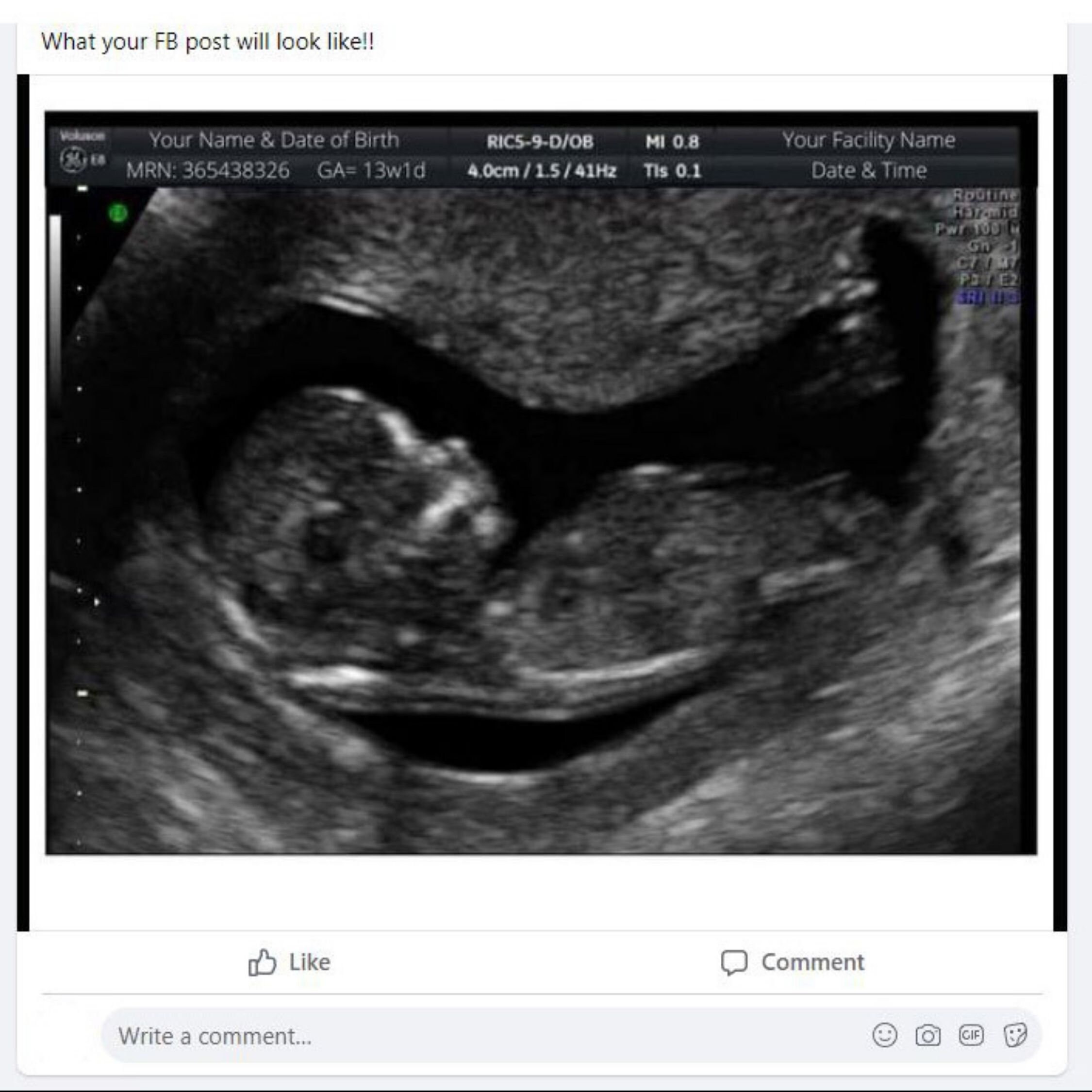 Fake Ultrasound Pictures Prank Ultrasound Picture Digital | Etsy