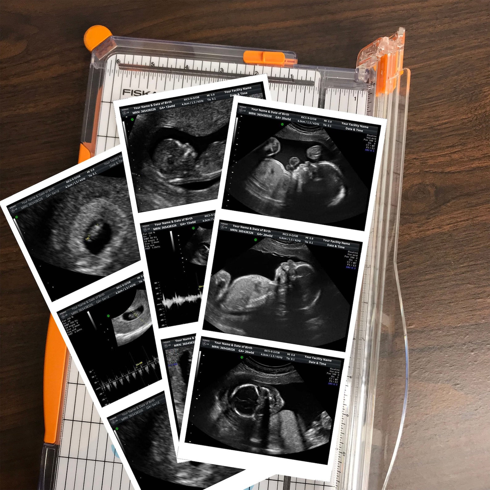 Fake Ultrasound Prank - rlx5z9x