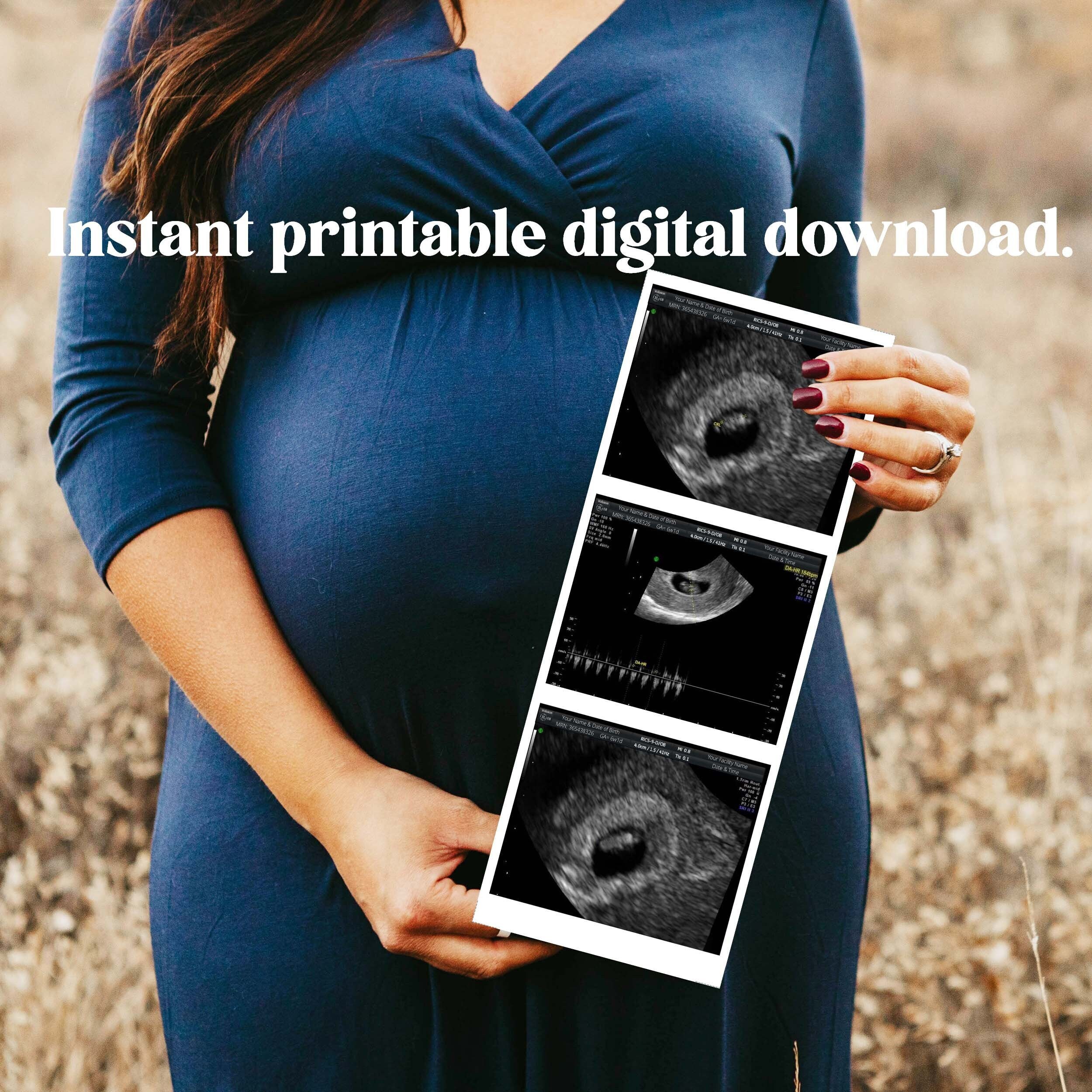 Fake Ultrasound Pictures Fake sonogram Prank Ultrasound | Etsy