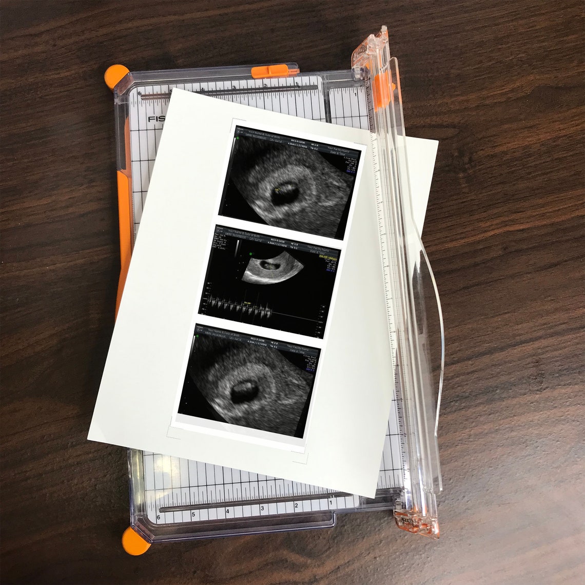 Fake Ultrasound Pictures Fake sonogram Prank Ultrasound | Etsy