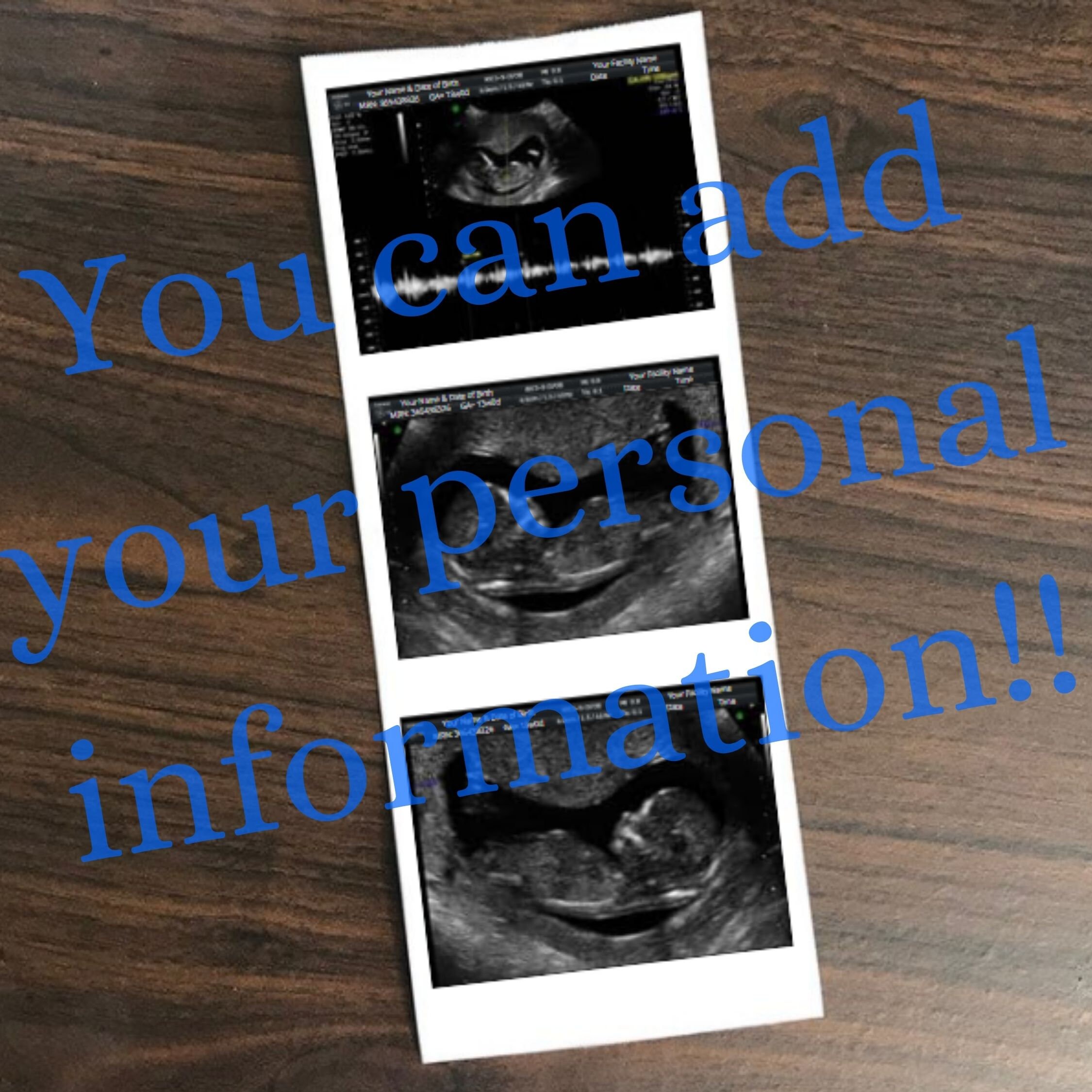 Fake Ultrasound Pictures Prank Ultrasound Picture Digital | Etsy