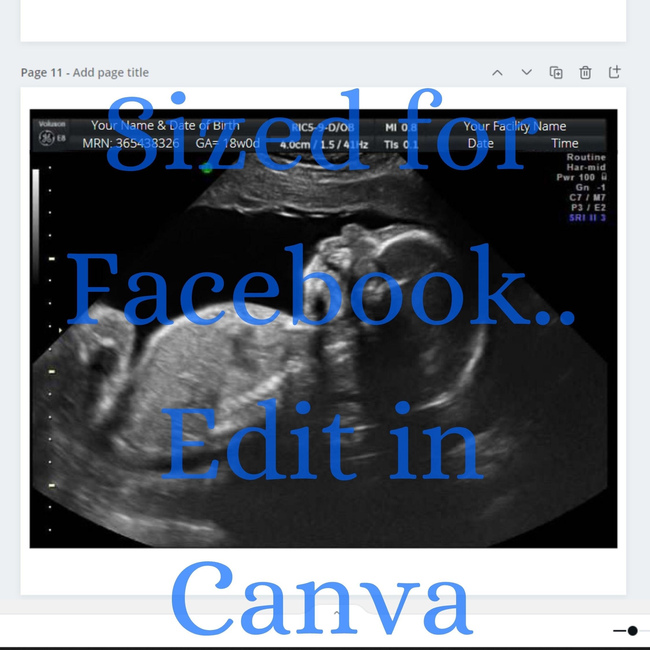 Fake Ultrasound Pictures Prank Ultrasound Picture Digital | Etsy