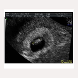 Fake Ultrasound Pictures Prank Ultrasound Picture Digital | Etsy