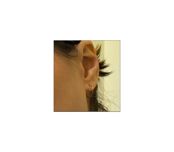 Ear Allure Weight Loss Earrings review 