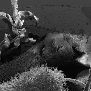 May include: A black and white close-up image of a fly's eye and other body parts, taken with a scanning electron microscope.
