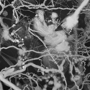 May include: A black and white close-up image of a cluster of white, stringy, organic matter with small, round, white dots.